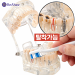 레아하브 클리어덴트 투명치아모형